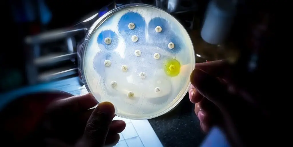 O bacterie veche de 5.000 de ani, descoperită în România - Corp sănătos