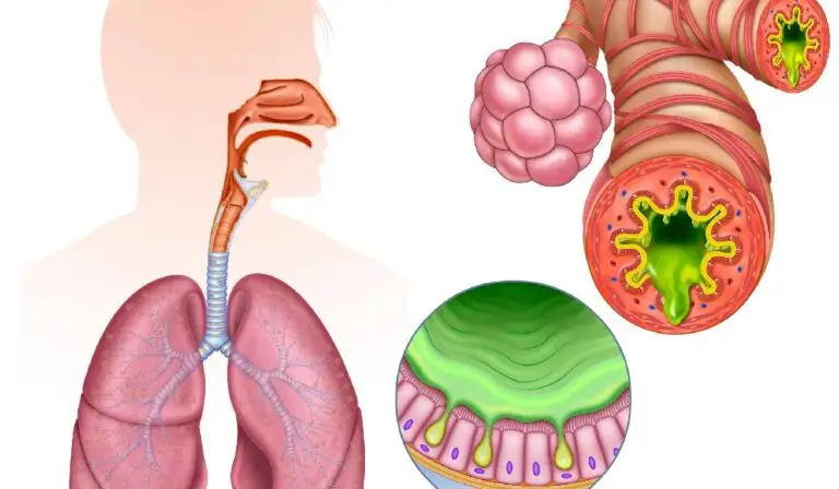 Inflamația cronică: dușmanul invizibil al sănătății tale