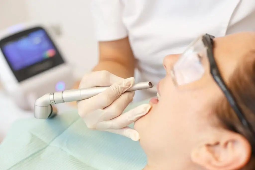 Albirea dentară cu laser: ce trebuie să știi despre această metodă - Corp sănătos