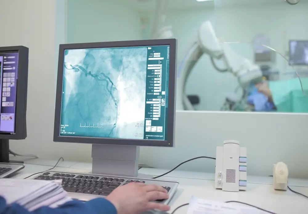 Când ajungi la coronarografie: semnele că inima ta cere mai mult - Corp sănătos