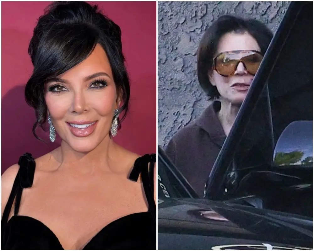 Kris Jenner și liftingul de 100.000 de dolari: ce spune - Corp sănătos