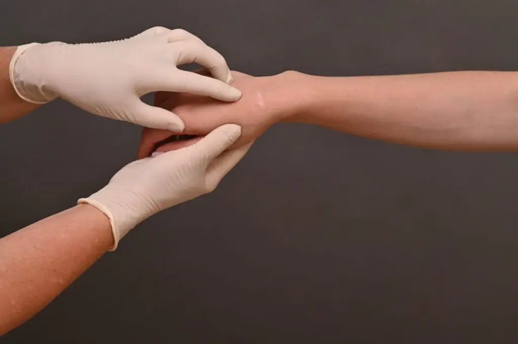 Remediul natural care estompează cicatricile - Corp sănătos