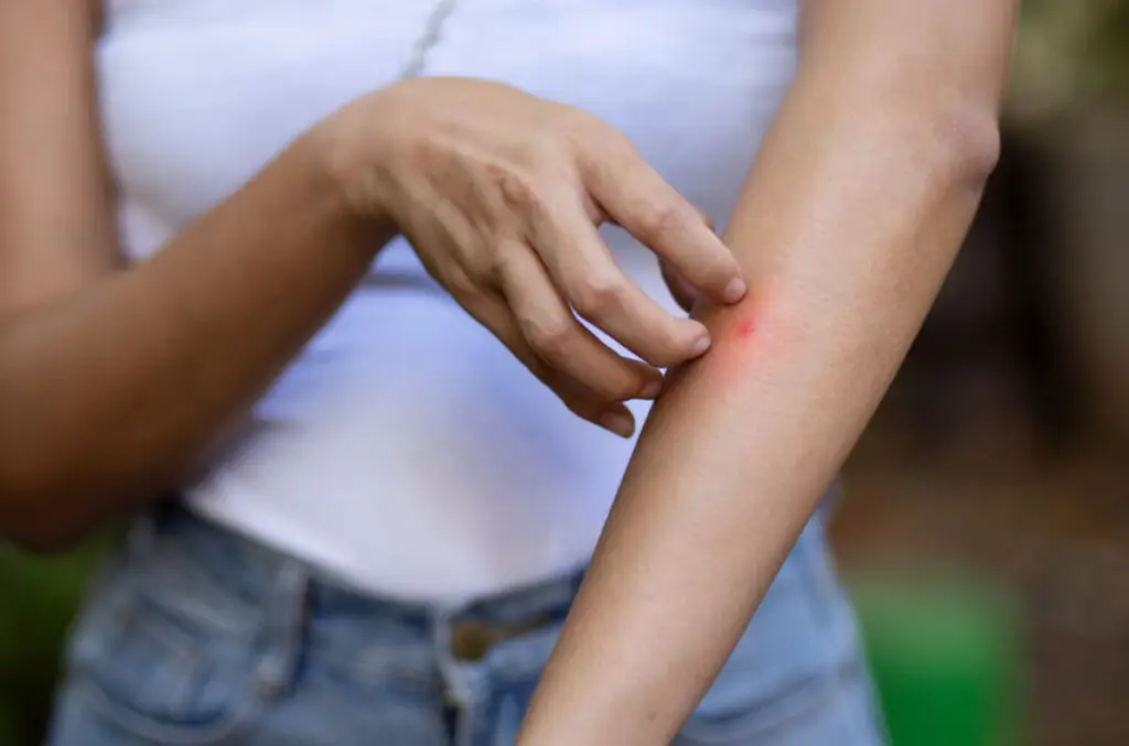 Virusul Chikungunya ar putea ajunge în Europa - Corp sănătos