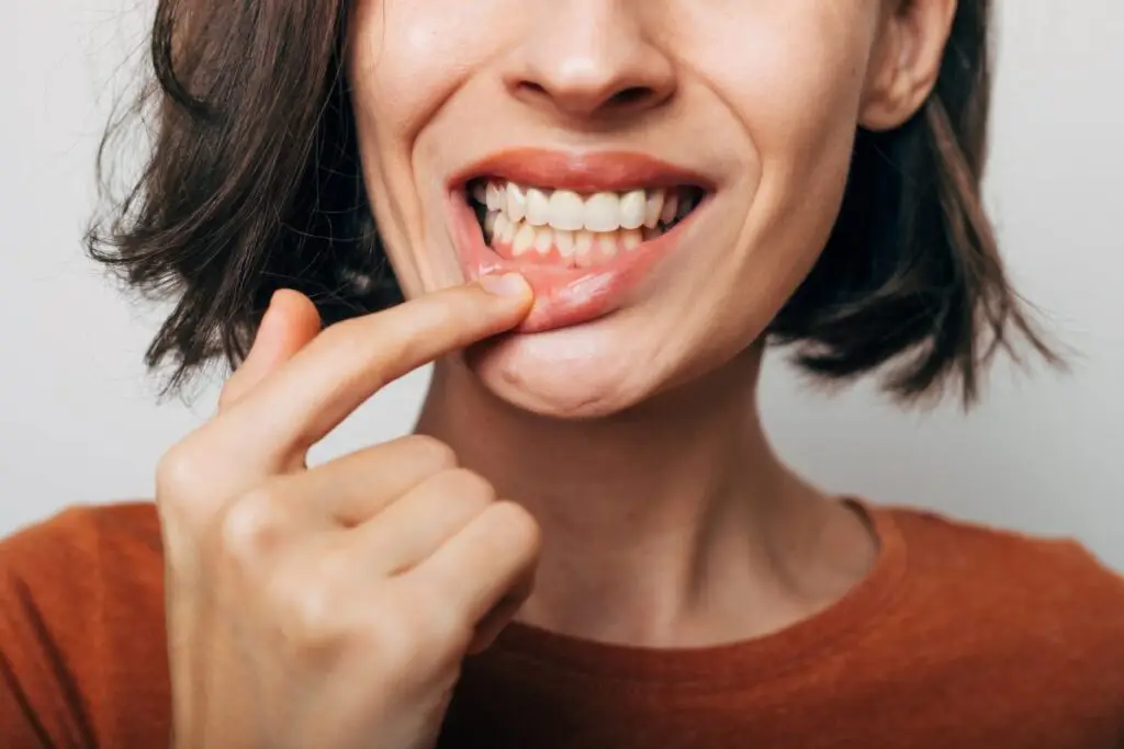 Trend periculos pe TikTok: tinerii își zgârie dinții acasă - Corp sănătos