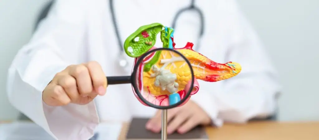 Un pahar de bere pe zi crește riscul de cancer pancreatic? - Corp sănătos
