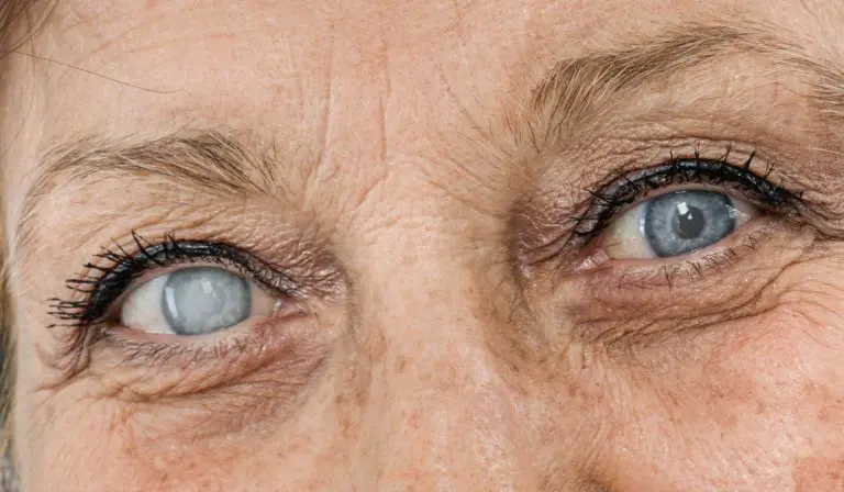 Cataracta apare tot mai devreme: rolul diabetului