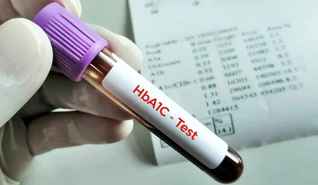 HbA1c mărit: nu e mereu despre glicemie. Ce altceva contează - Corp sănătos