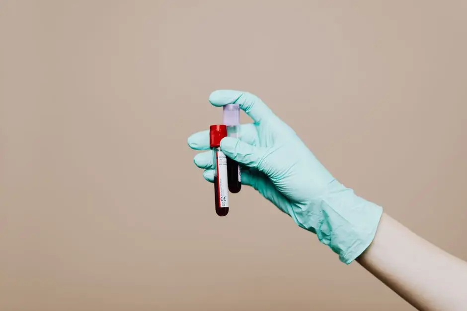 5 analize de sânge esențiale pe care trebuie să le faci înainte de primul antrenament la sală — Photo: https://kaboompics.com/ (Pexels)