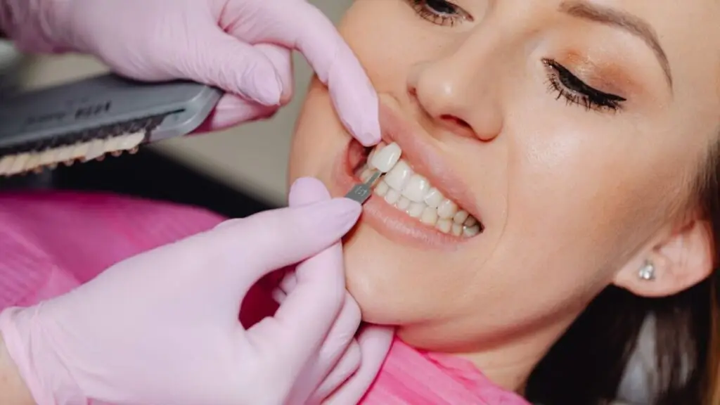 Cât costă fațetele dentare pentru toată gura - Corp sănătos